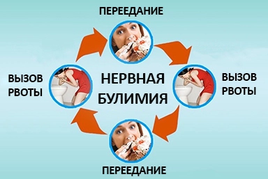 Лечение булимии в Сосновом Бору
